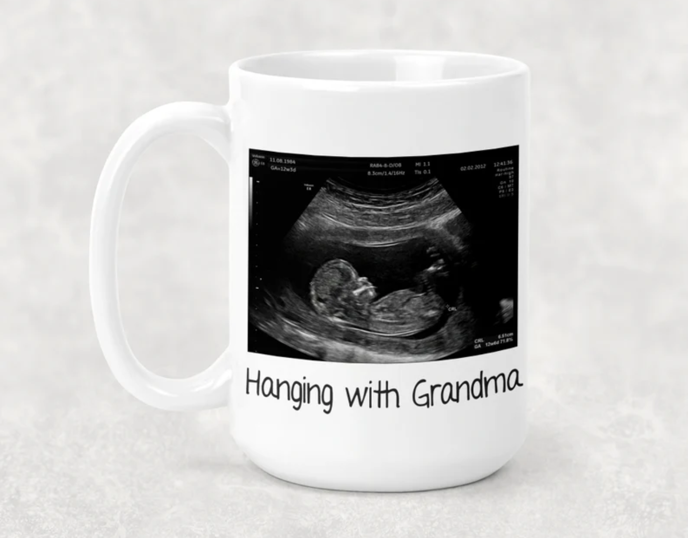 Ultrasound Mug, Expecting parents gift, Baby shower present, Pregnancy reveal, Father's day, Daddy to be gift idea, gifts for him, Dad mug