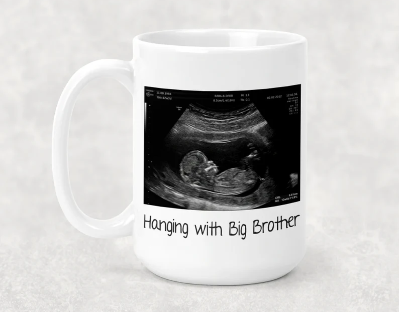 Ultrasound Mug, Expecting parents gift, Baby shower present, Pregnancy reveal, Father's day, Daddy to be gift idea, gifts for him, Dad mug